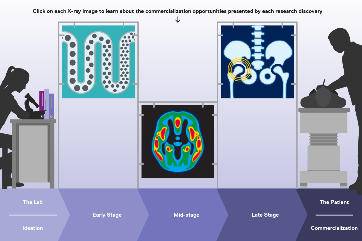 Diagram that highlights the work of three Ryerson professors and their commercialization opportunities as a result of their research discoveries. Each of the professors work is illustrated on a separate x-ray image, each shown at a different stage in the commercialization continuum. On the far left is the a silhouette of a woman looking into a microscope to highlight the ideation stage that happens in laboratories. On the far right is a physician examining a patient in a hospital setting to note the end of the commercialization continuum when a product is available for use. Noted in between are the early stage, midstage, and late stage steps in the process.